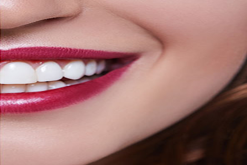 Aesthetic dentistry